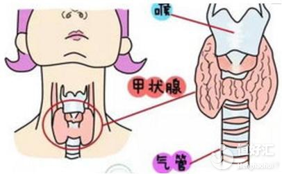 試管嬰兒為什么要查甲狀腺功能？醫(yī)生：圖的是這個(gè)