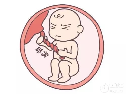 這樣做容易加重胎兒臍帶繞頸，孕媽媽們注意了！