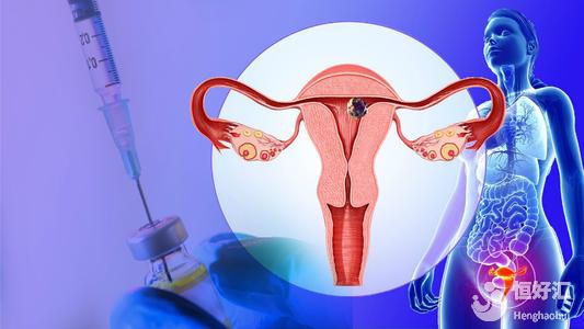 子宮切除后要注意什么？這些飲食準(zhǔn)則請(qǐng)收藏