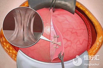 有25%的女人因為這個而不孕，你也是其中一個嗎？