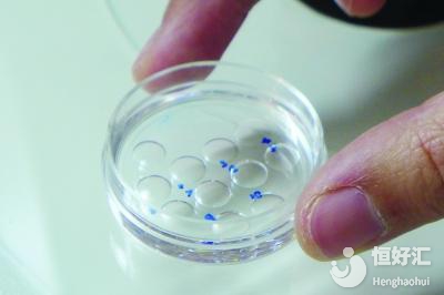 試管胚胎培養(yǎng)也分為3天與5天？移植哪個更好？