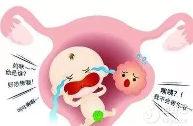 子宮肌瘤和懷孕能否共存？看完這個(gè)秒懂！