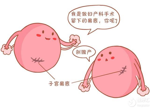 瘢痕子宮是什么？能做試管嬰兒?jiǎn)幔? />
									<div   id=